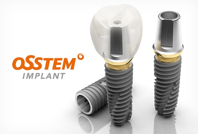 Корейські імпланти Osstem