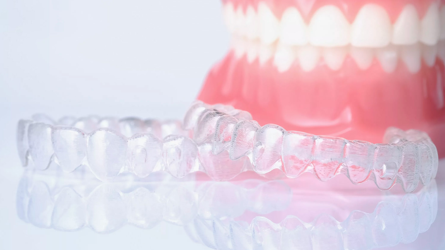 Ретейнери після брекетів: навіщо та скільки потрібно носити ретейнери для збереження вашої усмішки 4 Поради щодо підтримання результатів ортодонтичного лікування