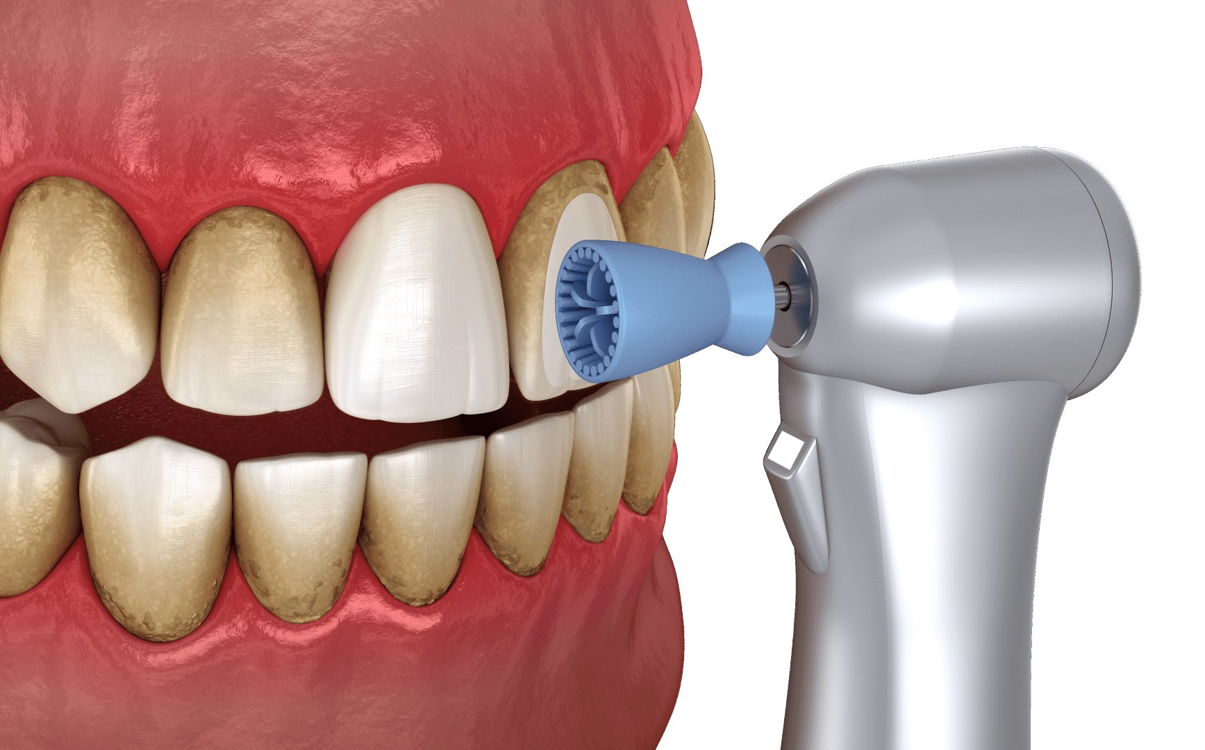 Запалення ясен: ознаки та лікування 2 Поради щодо підтримання здоров’я порожнини рота