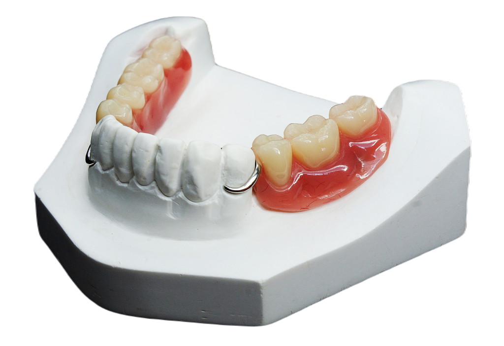 Які бувають зубні протези: огляд різновидів, матеріалів і правил догляду 2 Матеріали для зубних протезів