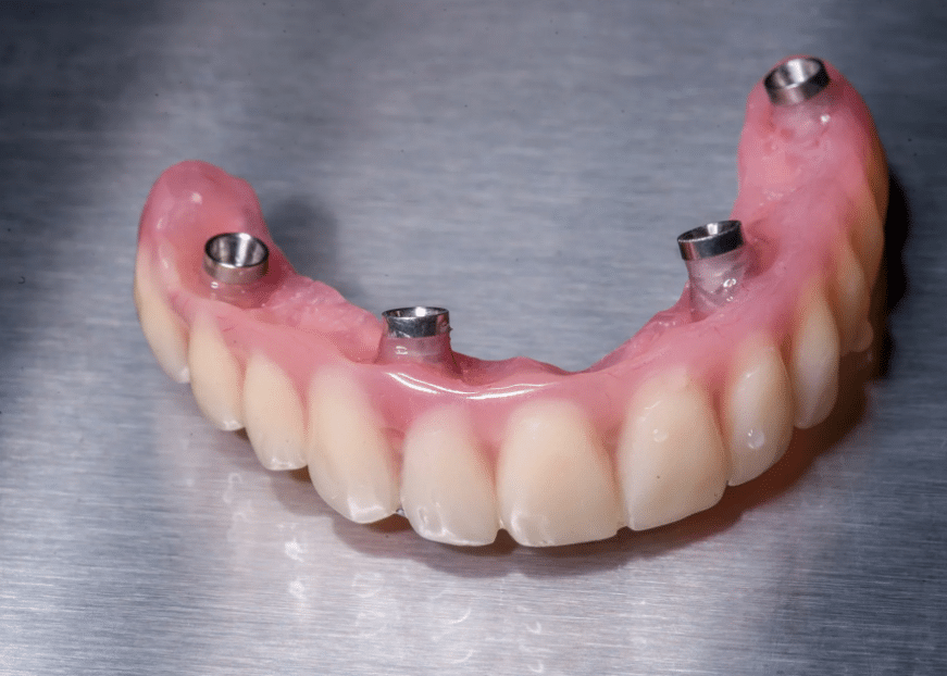 Клініка UkrDentClub – надійна допомога в галузі ортопедичної стоматології 3 Клініка ортопедичної стоматології UkrDentClub: 5 причин звернутися до нас