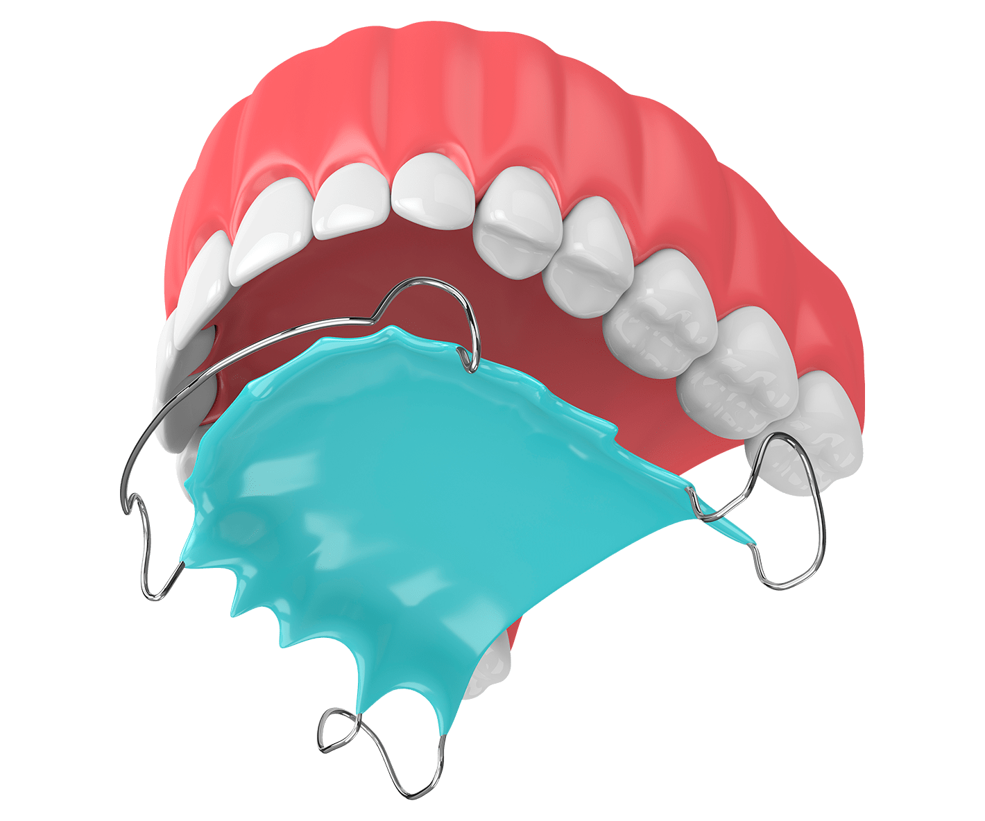 Механічні знімні апарати для корекції зубів