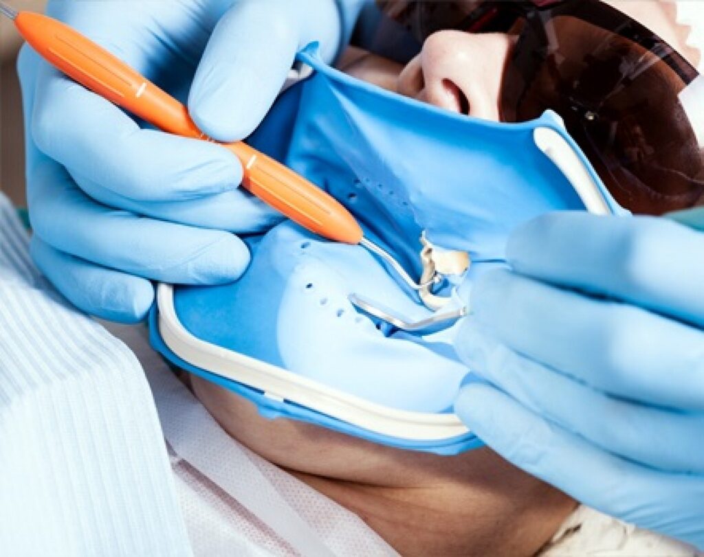 Ендодонтія: сучасні методи лікування кореневих каналів 2 Як лікувати запалення кореня зуба: основні етапи