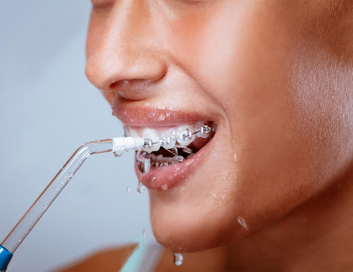 Зубна нитка vs іригатор: що краще для міжзубного простору 2 Різновиди іригаторів для зубів