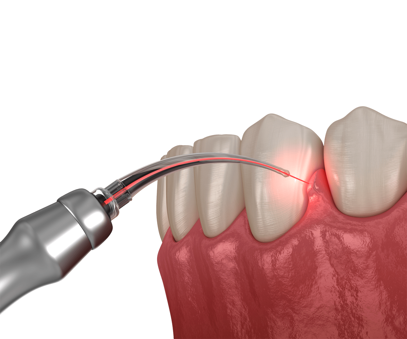 Що впливає на вартість лікування зубів 3 Що впливає на вартість лікування зубів