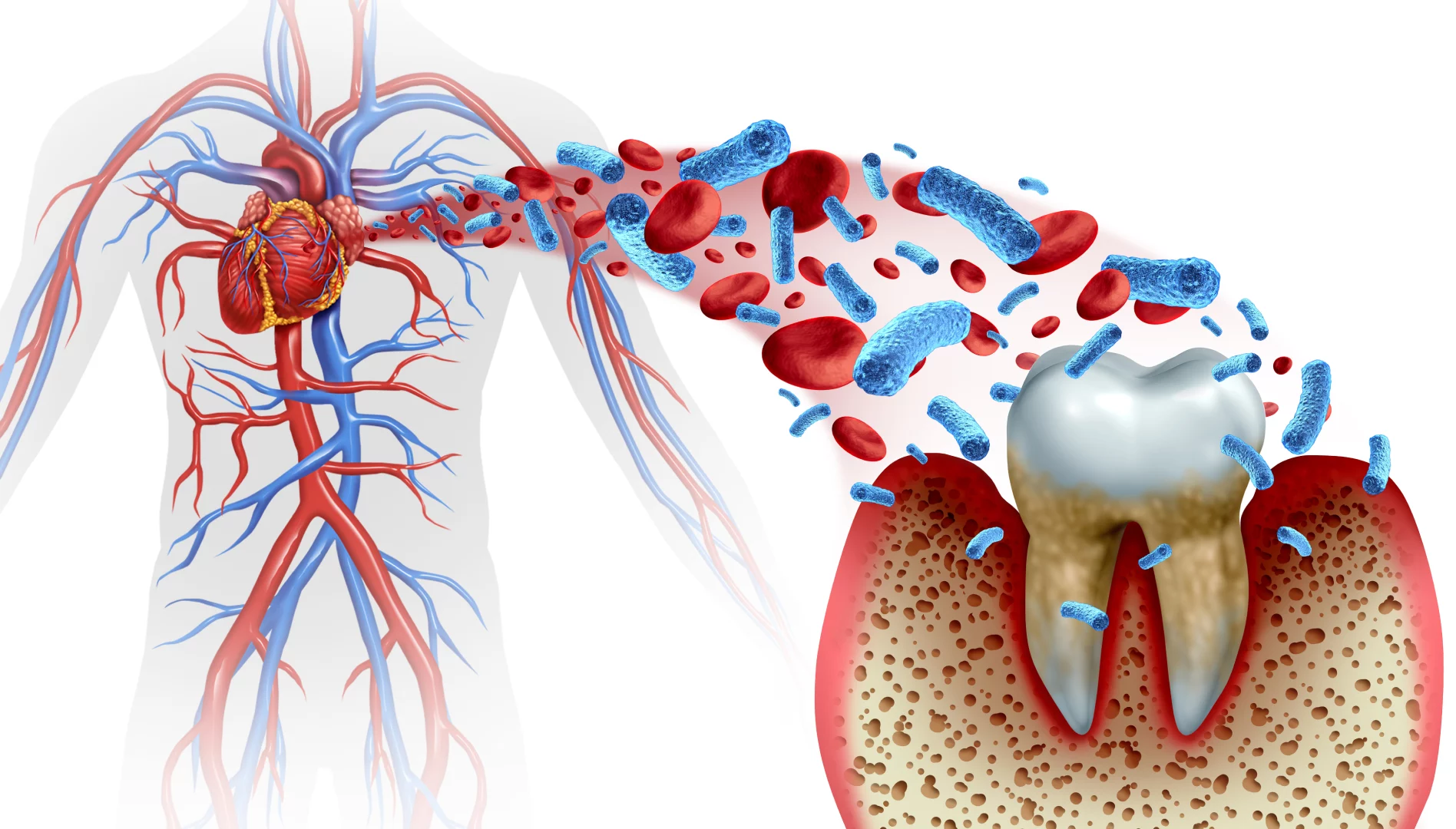 Вплив остеопорозу на можливість імплантації