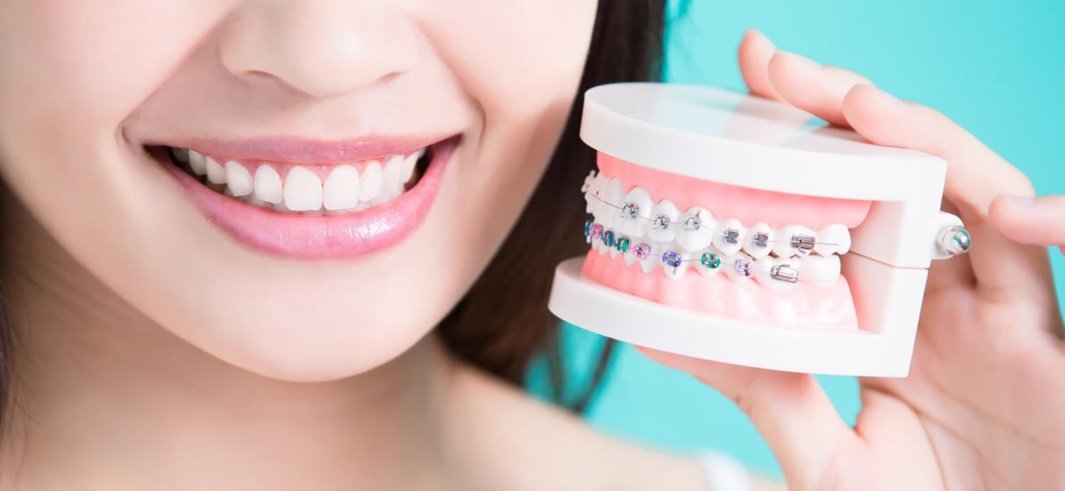 Ортогнатичний прикус 2 Переваги ортогнатичного прикусу для людини