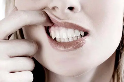 Хитається постійний зуб: що робити та чи можна його врятувати 3 Профілактика розхитування зубів у дорослих