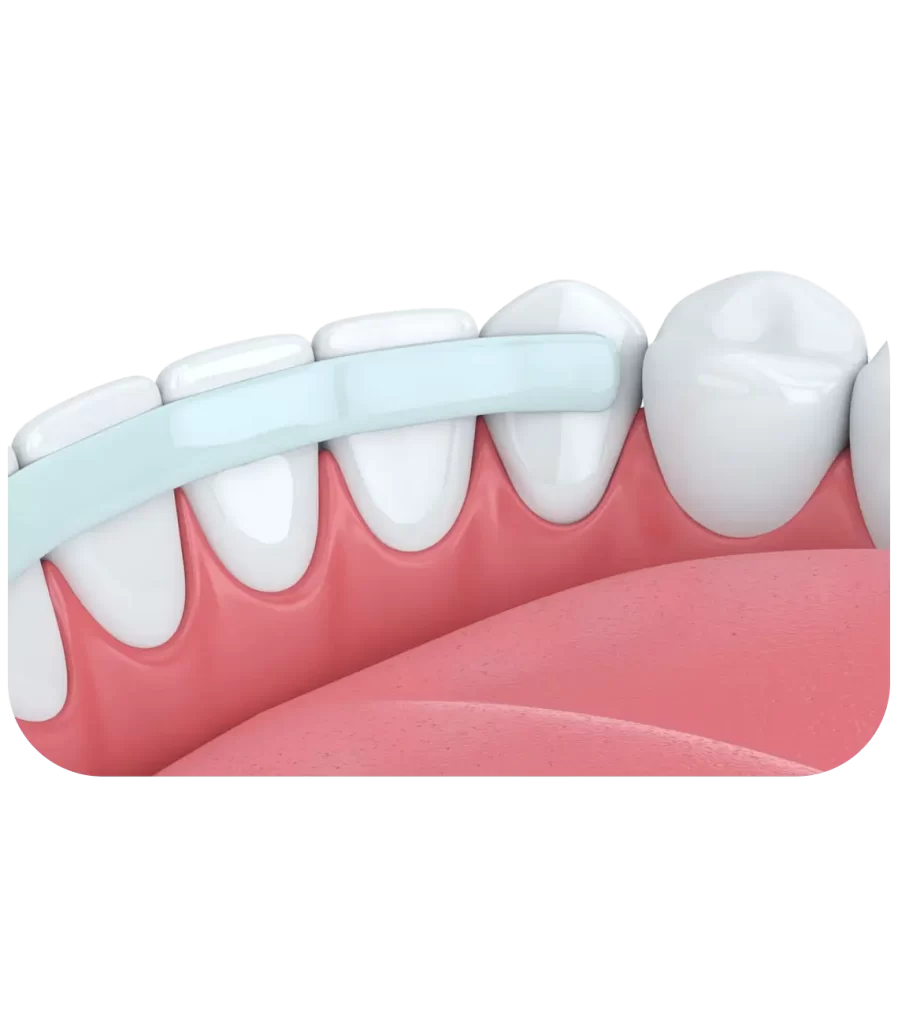 Конструктивні особливості шини Ельбрехта